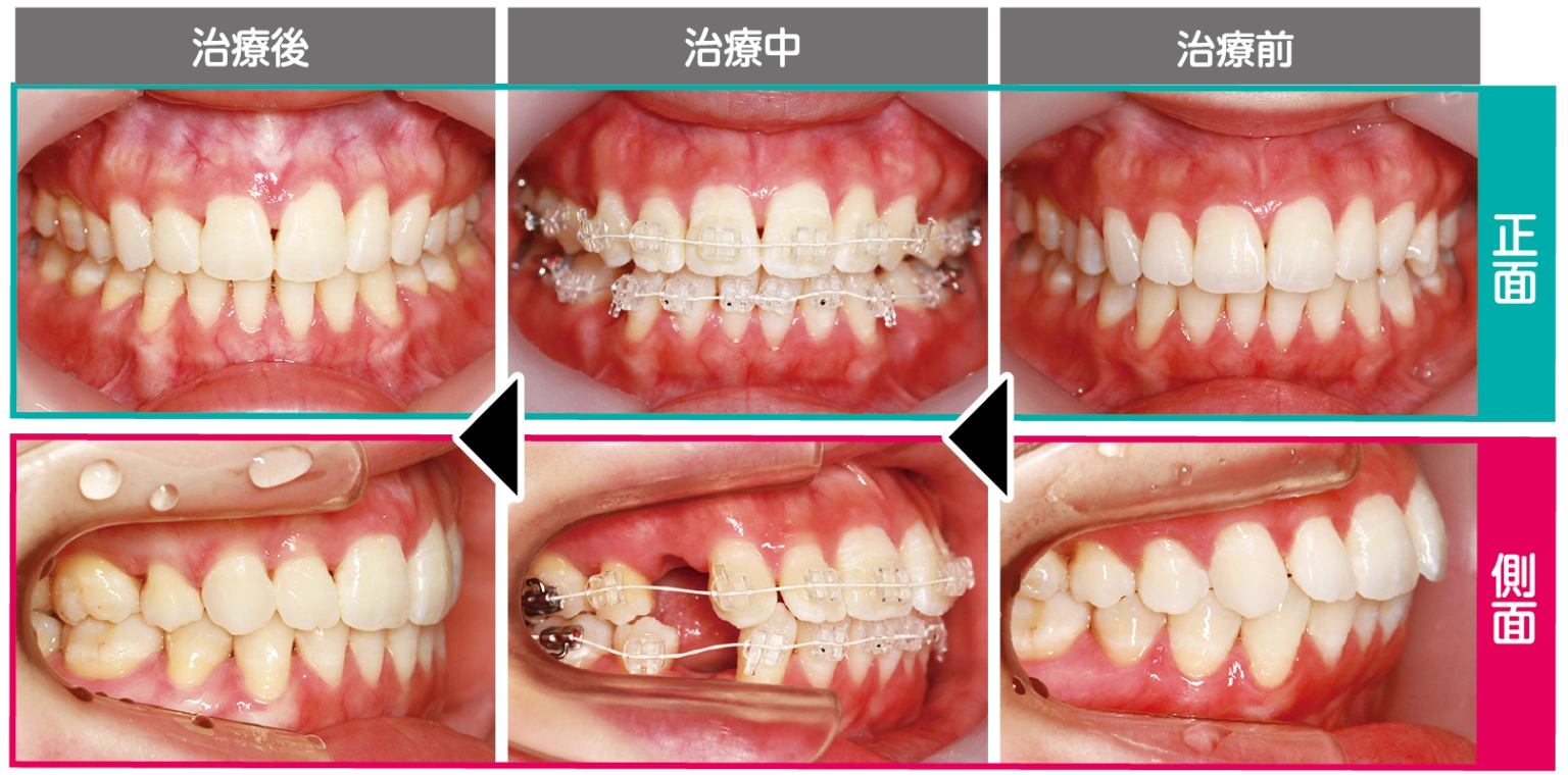 ふかつ歯科-01-1536x760 (1).png